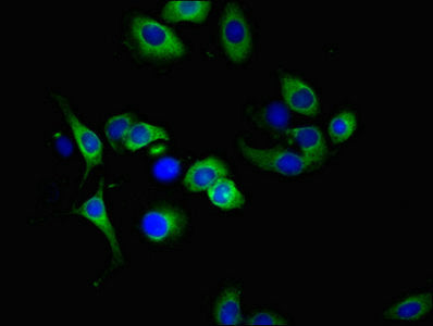 TNFRSF10A Polyclonal Antibody - image 5