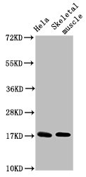 UBE2D3 Polyclonal Antibody - image 2