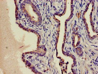 Immunofluorescent analysis of Hela cells using CAC13255 at dilution of 1:100 and Alexa Fluor 488-congugated AffiniPure Goat Anti-Rabbit IgG(H+L)