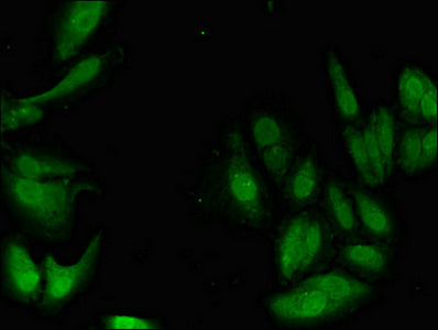 PIM1 Polyclonal Antibody - image 3