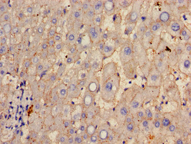 Immunofluorescent analysis of A549 cells using CAC13269 at dilution of 1:100 and Alexa Fluor 488-congugated AffiniPure Goat Anti-Rabbit IgG(H+L)
