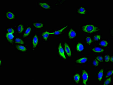 GGT1 Polyclonal Antibody - image 3