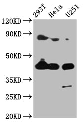 Immunohistochemistry of paraffin-embedded human kidney tissue using CAC13271 at dilution of 1:100