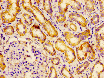 Immunofluorescence staining of HepG2 cells with CAC13309 at 1:200, counter-stained with DAPI. The cells were fixed in 4% formaldehyde, permeabilized using 0.2% Triton X-100 and blocked in 10% normal Goat Serum. The cells were then incubated with the antibody overnight at 4°C. The secondary antibody was Alexa Fluor 488-congugated AffiniPure Goat Anti-Rabbit IgG(H+L).