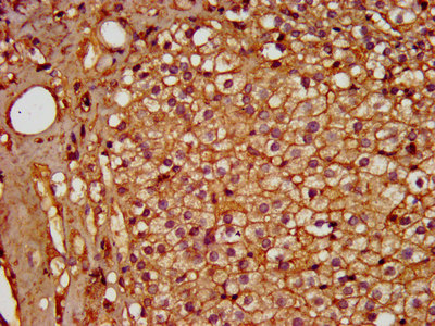 Immunofluorescence staining of A549 cells with CAC13335 at 1:200, counter-stained with DAPI. The cells were fixed in 4% formaldehyde, permeabilized using 0.2% Triton X-100 and blocked in 10% normal Goat Serum. The cells were then incubated with the antibody overnight at 4°C. The secondary antibody was Alexa Fluor 488-congugated AffiniPure Goat Anti-Rabbit IgG(H+L).