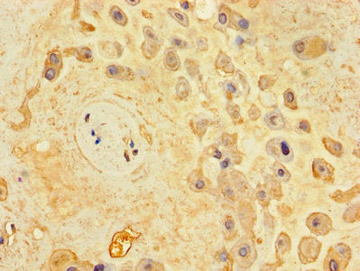 Immunohistochemistry of paraffin-embedded human brain tissue using CAC13337 at dilution of 1:100