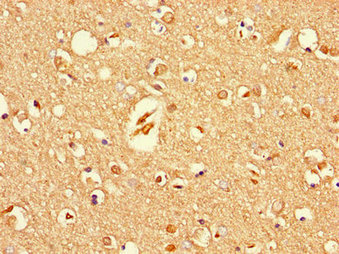 Immunofluorescent analysis of HepG2 cells using CAC13337 at dilution of 1:100 and Alexa Fluor 488-congugated AffiniPure Goat Anti-Rabbit IgG(H+L)