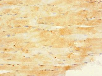 Immunohistochemistry of paraffin-embedded human heart tissue using CAC13341 at dilution of 1:100