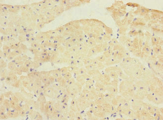 PPP1R3A Polyclonal Antibody - image 3