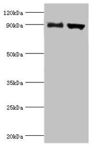 Immunohistochemistry of paraffin-embedded human liver cancer using CAC13346 at dilution of 1:100