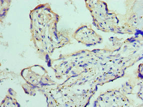 ADAM9 Polyclonal Antibody - image 4