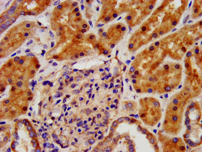 IHC image of CAC13353 diluted at 1:500 and staining in paraffin-embedded human brain tissue performed on a Leica BondTM system. After dewaxing and hydration, antigen retrieval was mediated by high pressure in a citrate buffer (pH 6.0). Section was blocked with 10% normal goat serum 30min at RT. Then primary antibody (1% BSA) was incubated at 4°C overnight. The primary is detected by a biotinylated secondary antibody and visualized using an HRP conjugated SP system.