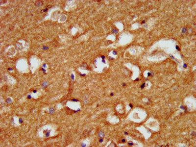 Immunofluorescence staining of A549 cells with CAC13353 at 1:166, counter-stained with DAPI. The cells were fixed in 4% formaldehyde, permeabilized using 0.2% Triton X-100 and blocked in 10% normal Goat Serum. The cells were then incubated with the antibody overnight at 4°C. The secondary antibody was Alexa Fluor 488-congugated AffiniPure Goat Anti-Rabbit IgG(H+L).