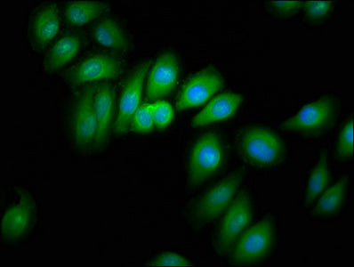 CRYM Polyclonal Antibody - image 4