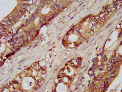 Immunofluorescence staining of Hela cells with CAC13371 at 1:33, counter-stained with DAPI. The cells were fixed in 4% formaldehyde, permeabilized using 0.2% Triton X-100 and blocked in 10% normal Goat Serum. The cells were then incubated with the antibody overnight at 4°C. The secondary antibody was Alexa Fluor 488-congugated AffiniPure Goat Anti-Rabbit IgG(H+L).