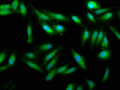 UMPS Polyclonal Antibody - image 4