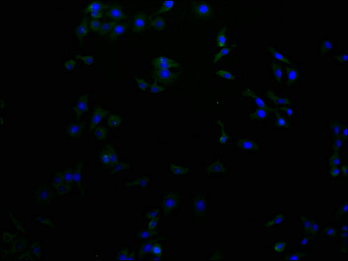 RHBDF2 Polyclonal Antibody - image 3