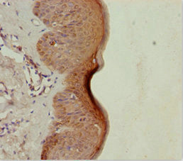 LRSAM1 Polyclonal Antibody - image 3