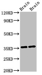 IHC image of CAC13387 diluted at 1:1200 and staining in paraffin-embedded human cervical cancer performed on a Leica BondTM system. After dewaxing and hydration, antigen retrieval was mediated by high pressure in a citrate buffer (pH 6.0). Section was blocked with 10% normal goat serum 30min at RT. Then primary antibody (1% BSA) was incubated at 4°C overnight. The primary is detected by a biotinylated secondary antibody and visualized using an HRP conjugated SP system.
