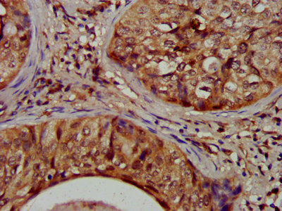 Immunofluorescence staining of HepG2 cells with CAC13387 at 1:400, counter-stained with DAPI. The cells were fixed in 4% formaldehyde, permeabilized using 0.2% Triton X-100 and blocked in 10% normal Goat Serum. The cells were then incubated with the antibody overnight at 4°C. The secondary antibody was Alexa Fluor 488-congugated AffiniPure Goat Anti-Rabbit IgG(H+L).