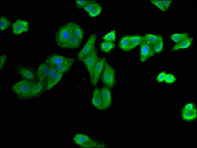 NIT1 Polyclonal Antibody - image 4