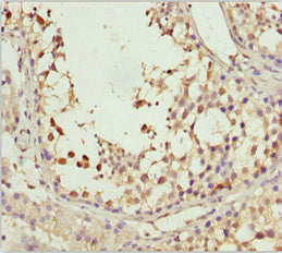 SPRED2 Polyclonal Antibody - image 2