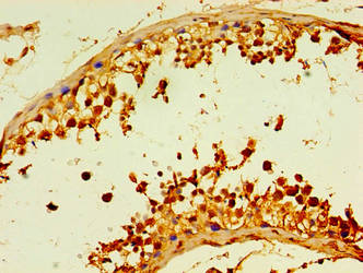 Immunohistochemistry of paraffin-embedded human kidney tissue using CAC13397 at dilution of 1:100