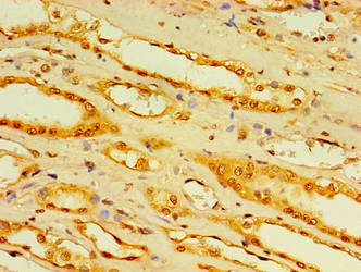 DCP2 Polyclonal Antibody - image 3