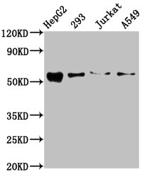 IHC image of CAC13400 diluted at 1:600 and staining in paraffin-embedded human colon cancer performed on a Leica BondTM system. After dewaxing and hydration, antigen retrieval was mediated by high pressure in a citrate buffer (pH 6.0). Section was blocked with 10% normal goat serum 30min at RT. Then primary antibody (1% BSA) was incubated at 4°C overnight. The primary is detected by a biotinylated secondary antibody and visualized using an HRP conjugated SP system.
