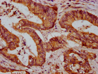 Immunofluorescence staining of HepG2 cells with CAC13400 at 1:200, counter-stained with DAPI. The cells were fixed in 4% formaldehyde, permeabilized using 0.2% Triton X-100 and blocked in 10% normal Goat Serum. The cells were then incubated with the antibody overnight at 4°C. The secondary antibody was Alexa Fluor 488-congugated AffiniPure Goat Anti-Rabbit IgG(H+L).