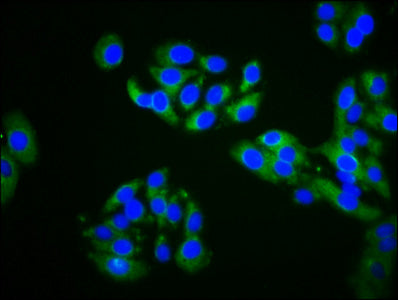ZDHHC14 Polyclonal Antibody - image 4