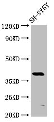 IHC image of CAC13406 diluted at 1:400 and staining in paraffin-embedded human brain tissue performed on a Leica BondTM system. After dewaxing and hydration, antigen retrieval was mediated by high pressure in a citrate buffer (pH 6.0). Section was blocked with 10% normal goat serum 30min at RT. Then primary antibody (1% BSA) was incubated at 4°C overnight. The primary is detected by a biotinylated secondary antibody and visualized using an HRP conjugated SP system.