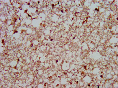 Immunofluorescence staining of Hela cells with CAC13406 at 1:133, counter-stained with DAPI. The cells were fixed in 4% formaldehyde, permeabilized using 0.2% Triton X-100 and blocked in 10% normal Goat Serum. The cells were then incubated with the antibody overnight at 4°C. The secondary antibody was Alexa Fluor 488-congugated AffiniPure Goat Anti-Rabbit IgG(H+L).