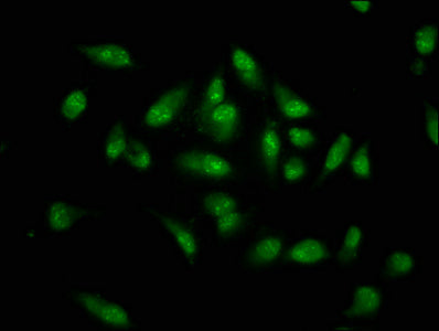 MKX Polyclonal Antibody - image 4
