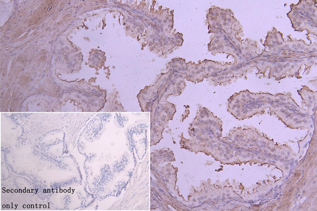 ZDHHC12 Polyclonal Antibody - image 2