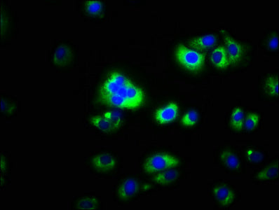 Western Blot, All lanes: CAPNS2 antibody at 8ug/ml + Mouse heart tissue, Secondary, Goat polyclonal to rabbit IgG at 1/10000 dilution, Predicted band size: 28 kDa, Observed band size: 28 kDa