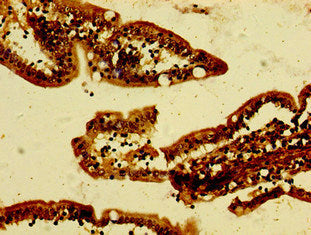 ANKRD49 Polyclonal Antibody - image 3