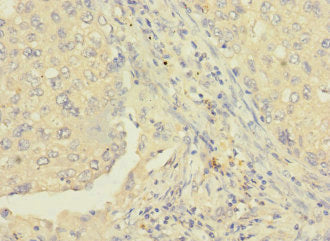 RAB8B Polyclonal Antibody - image 2