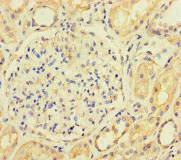 Immunofluorescent analysis of HepG2 cells using CAC13431 at dilution of 1:100 and Alexa Fluor 488-congugated AffiniPure Goat Anti-Rabbit IgG(H+L)