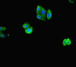 Western Blot, Positive WB detected in: Mouse heart tissue, Mouse skeletal muscle tissue, All lanes: ACTL9 antibody at 3.25ug/ml, Secondary, Goat polyclonal to rabbit IgG at 1/50000 dilution, Predicted band size: 46 kDa, Observed band size: 46, 35 kDa