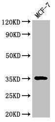 Immunofluorescent analysis of HepG2 cells using CAC13439 at dilution of 1:100 and Alexa Fluor 488-congugated AffiniPure Goat Anti-Rabbit IgG(H+L)