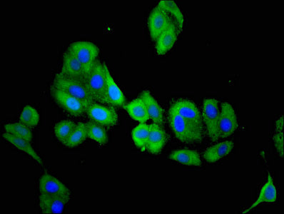 ACY3 Polyclonal Antibody - image 3