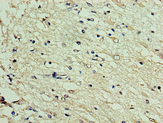 Immunohistochemistry of paraffin-embedded human kidney tissue using CAC13444 at dilution of 1:100