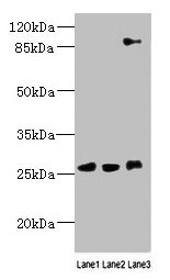 DNAJC30 Polyclonal Antibody - image 4