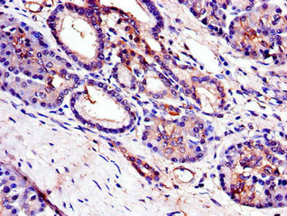 TRIB3 Polyclonal Antibody - image 3