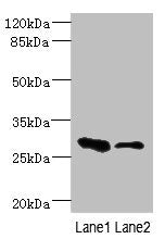 Immunohistochemistry of paraffin-embedded human brain tissue using CAC13460 at dilution of 1:100