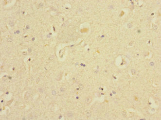 Immunohistochemistry of paraffin-embedded human heart tissue using CAC13460 at dilution of 1:100