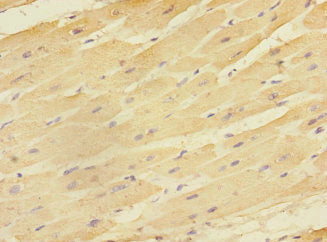 EAF2 Polyclonal Antibody - image 4