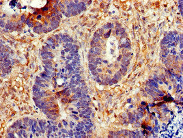 CDC6 Polyclonal Antibody - image 3