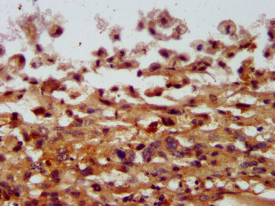 Immunofluorescence staining of MCF-7 cells with CAC13477 at 1:133, counter-stained with DAPI. The cells were fixed in 4% formaldehyde, permeabilized using 0.2% Triton X-100 and blocked in 10% normal Goat Serum. The cells were then incubated with the antibody overnight at 4°C. The secondary antibody was Alexa Fluor 488-congugated AffiniPure Goat Anti-Rabbit IgG(H+L).